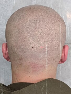 バーバーバー 八広(BARBER-BAR) スキンヘッド