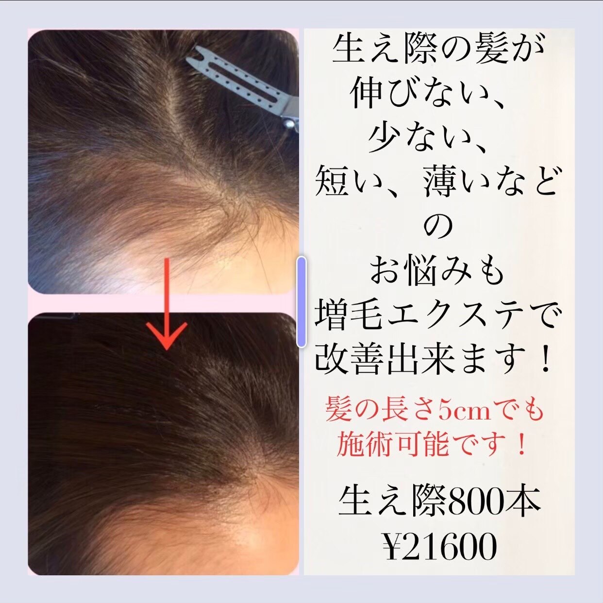 お試し！増毛エクステヘアループ☆200本！生え際のボリュームUP