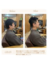 グランバイ アトリエドングリ(Grand × AtlierDonguri)&nbsp;お客様髪質改善データ2042（男性の髪型サイド比較）