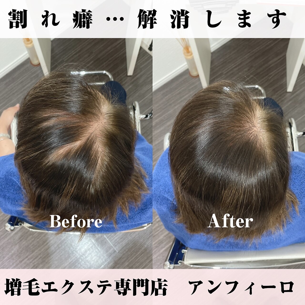 増毛エクステ(ヘアループ)2000本：L028893095｜アンフィーロ(An filo