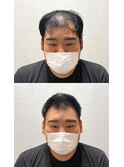 30代40代50代U字刈り上げソフトモヒカン飯田橋水道橋市谷神楽坂