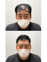 リライブ 飯田橋(RELIVE) 30代40代50代U字刈り上げソフトモヒカン飯田橋水道橋市谷神楽坂