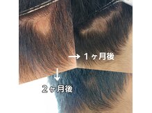 エワル(Ewalu)の雰囲気（頭皮トラブルやお悩みや不安など、一緒に解消していきましょう。）