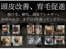 アンドグレイ 東京町屋店(and gray.)の雰囲気(独自プロダクトで頭皮改善,育毛促進!!髪と頭皮を健やかにします)