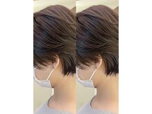 オプティマヘアー(Optima Hair)