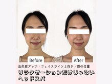 ウイザード(WIZARD)の雰囲気（頭皮からリフトアップ!美髪も叶えるヘッドスパ ）