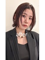 ライラ(LAILA) Before after