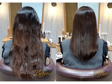 もっと早く相談すればよかった・・ストレートエステ/施術事例