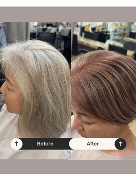 レディアル 大宮(REDEAL ope.) 白髪手術 / 白髪ぼかしハイライト