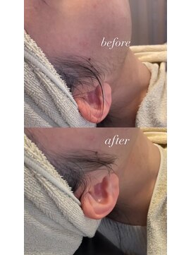 ヘアーイーダッシュ(HAIR E') 襟足＋顔シェービング