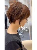 ライラ(LAILA) Before after