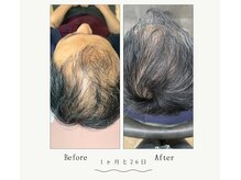 カームバイリコ 学芸大学(calm by liko)の雰囲気（男女問わず効果あり◎【高濃度ヒト幹細胞による頭皮ケア】）