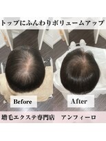 アンフィーロ(An filo)&nbsp;増毛エクステ（ヘアループ）1200本