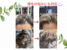 美容室ブラスパの雰囲気（3万円のヒト幹細胞上清液をシェアするスペシャルコース6600円）