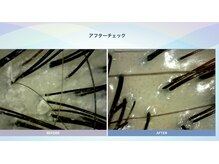 【仕上げ＋アフター診断】