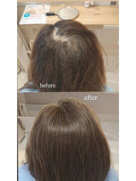 ウィベリー(Weevery) ＜部分ウィッグ＞SSサイズ｜ロング