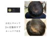 【強髪】ヒト幹細胞培養液濃度100%強髪3ヶ月6回コース　85030→￥62000