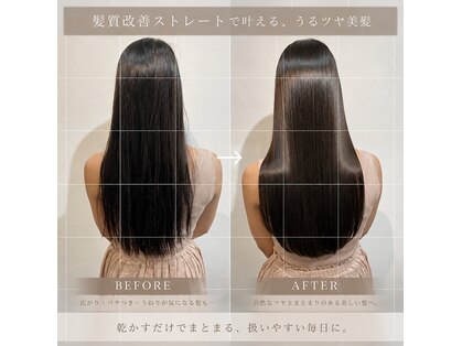 シェデルロア(SHEDEL LoA)の写真