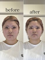 ヘアホスピタル ファニーフェイス(HAIR HOSPITAL funny face) 骨格補正スパ・バランス小顔矯正/暗めカラー