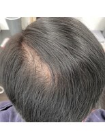 レイディバードカラー 籠原店&nbsp;30分のリタッチカラー（根元白髪染め）