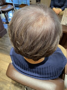 ヴィラ アンド テラス(Villa X terrace) エイジングケア