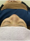 左右差の出にくいマツエク