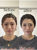 骨格補正スパ・バランス小顔矯正
