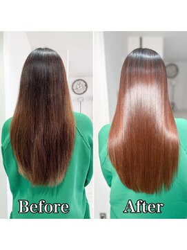 エセット(ECET) ECET式ストレート