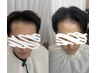 【男性限定】韓国式増毛リペア15束2520本／M字・前髪補強
