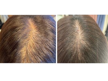38 ミヤ(MIYA)の写真/【生え際・つむじ・毛量のお悩みに】一人ひとりの髪に合わせた自然なボリュームをご提案