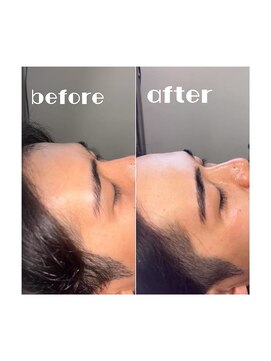 アルコ(ALCO) 艶肌フェイスワックス(全顔)