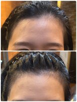 ヘアアトリエオット(hair atelier 8 otto)&nbsp;ヘアライン修正