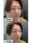 メンズ眉毛パーマ