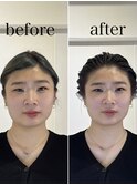 骨格補正スパ・小顔矯正