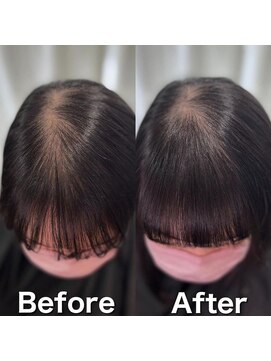 ツムグ 代官山店(TUMUGU) おとな女性髪悩み地肌見え解消【ボリュームアップエクステ】