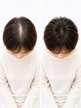ビフィーノ リルネ(Bifino Rilune)の写真/つむじ割れとトップのボリューム不足を自然に整えるショートで、後ろ姿まで美しく若々しい印象へ