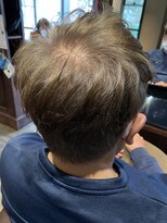 ヴィラ アンド テラス(Villa X terrace)&nbsp;エイジング