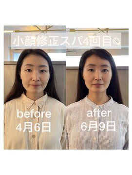 カミベヤ(KAMIBEYA) 骨格補正スパ4回目