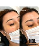 カイ(kai)&nbsp;ハリウッドブロウリフト