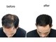 ラソヘアー(Lazo hair)の写真
