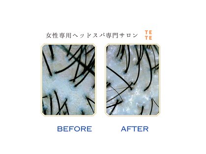 テテ(TETE)の写真