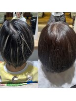 ベコ(Beco)&nbsp;後頭部ぱっくり割れ解消20代30代40代人気◎当店限定