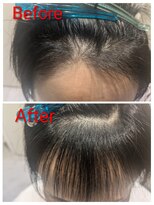 コティ(Kotii)&nbsp;【特許技術】エンジェリックケアで生え癖改善！