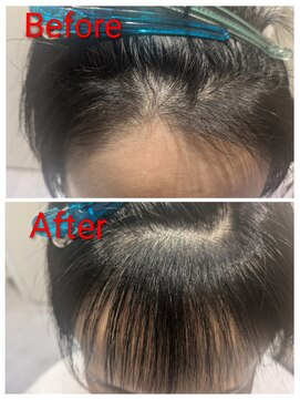 コティ(Kotii) 【特許技術】エンジェリックケアで生え癖改善!