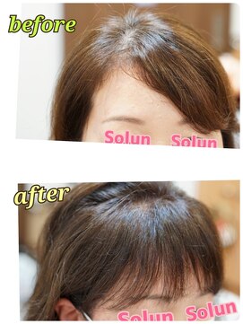 シャイニーソルン 前髪の割れをリセットして、やりたかった可愛い前髪にリメイク