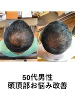 髪もよう&nbsp;育毛促進コース