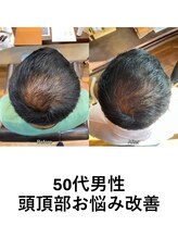 髪もよう&nbsp;育毛促進コース