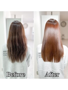 エセット(ECET) ECET式ストレート