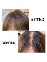 ヘアーサロン ココア(hair salon cocoa) 分け目改善