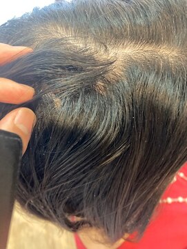 グランバイ アトリエドングリ(Grand × AtlierDonguri) 髪質改善 ビフォーアフター その19